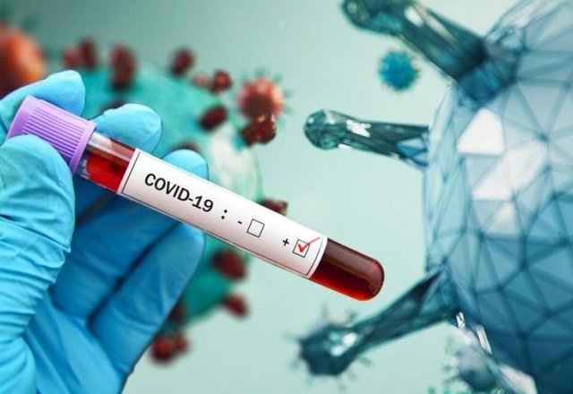 COVID-19 statistika: Lazdijų rajonas – 31 vietoje iš 60 Lietuvos savivaldybių